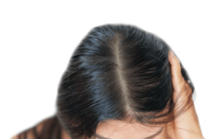 Fix Oily Scalp with Plant-Based Scalp Treatment - Page Header